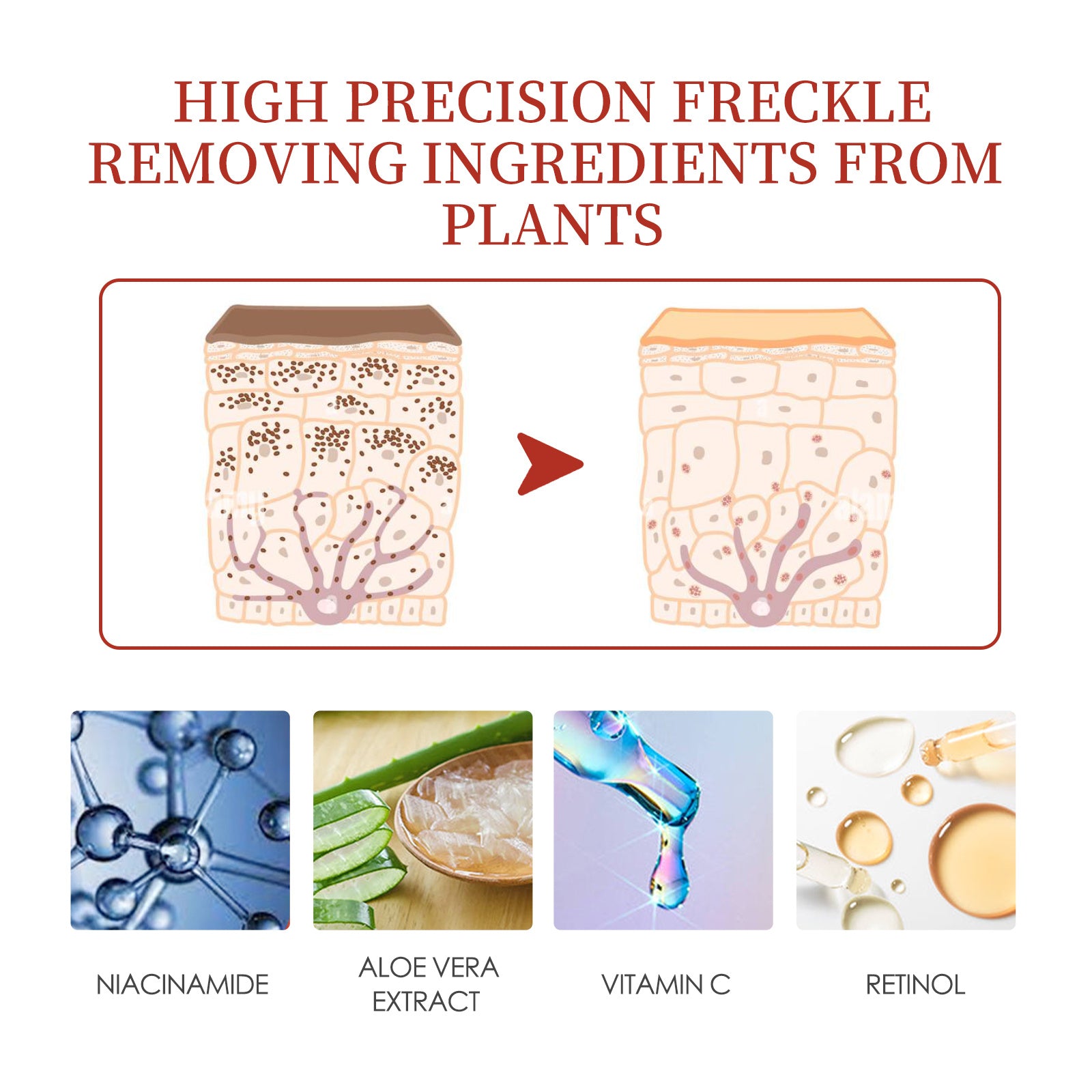 EELHOE Color Repair Cream Replenishes, Moisturizes, And Lightens Freckles, Black Spots, Blemishes, Melasma, And Melanin Skin Cream